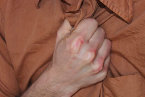 Hier kommt später der Alt-Text rein.